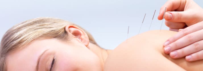 Chiropractic Bettendorf IA acupuncture Chiropractic Bettendorf IA acupuncture